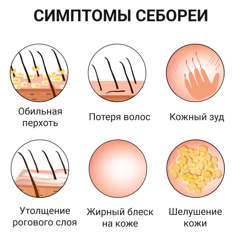 Научный подход в диагностике и лечении себореи